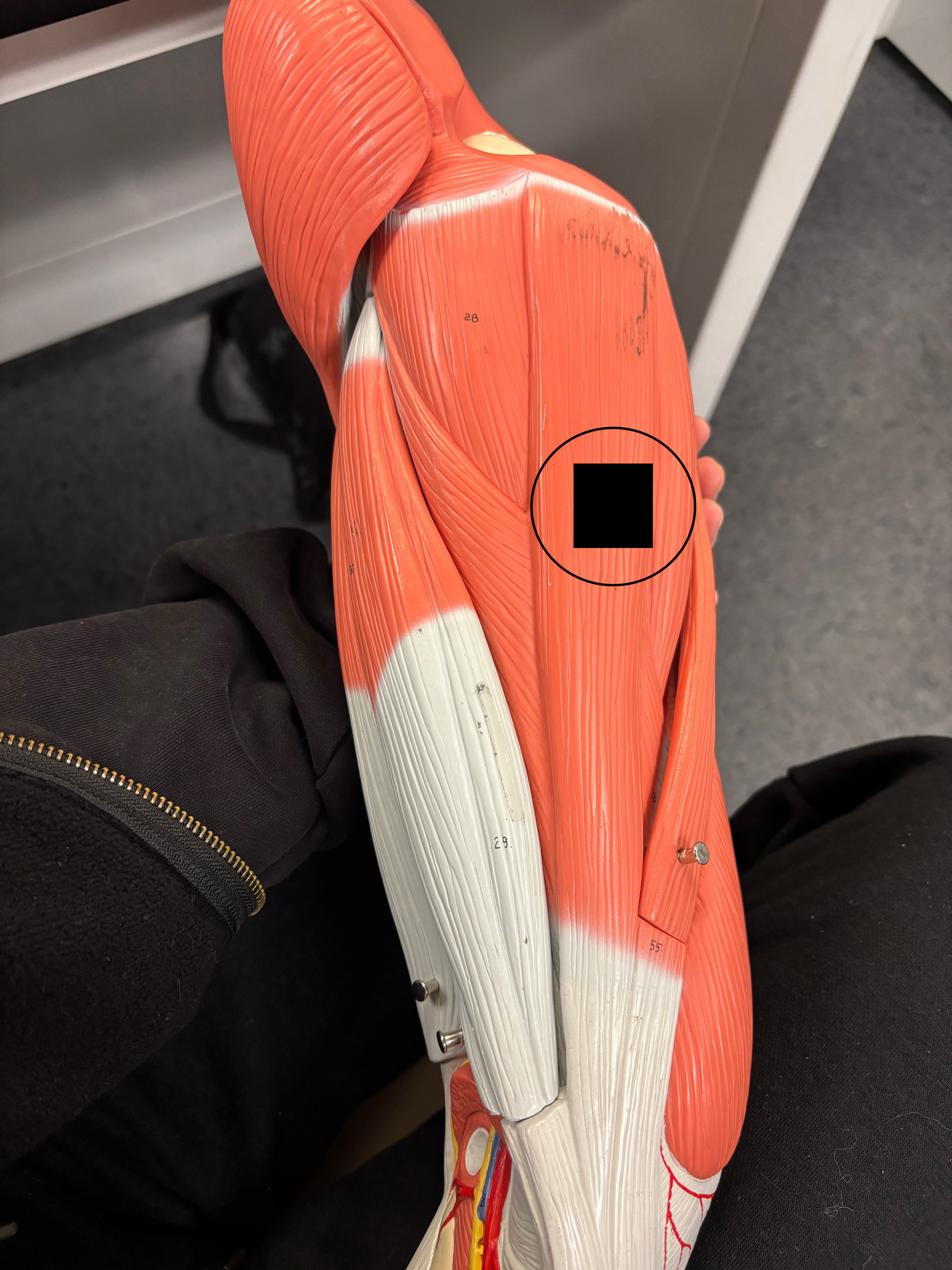 <p>What muscle is this and what is its action?</p>