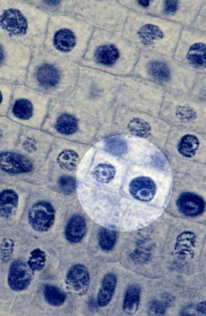 <p>What stage of mitosis is shown? </p>
