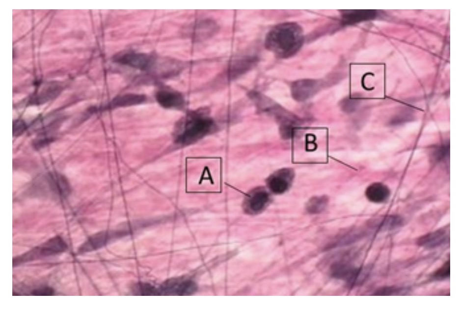 <p>name structure B</p>