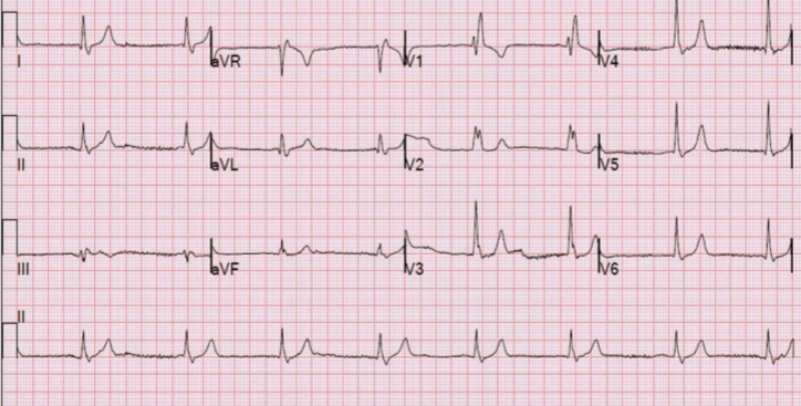 <p>What rhythm is this?</p>