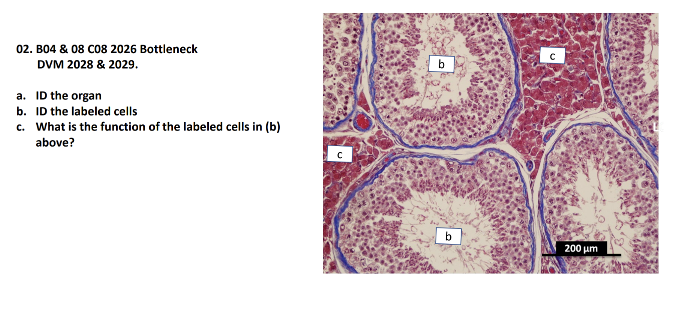 <p>a. ID the organ</p><p>b. ID the labeled cells</p><p>c. What is the function of the labeled cells in (b) </p><p>above?</p>