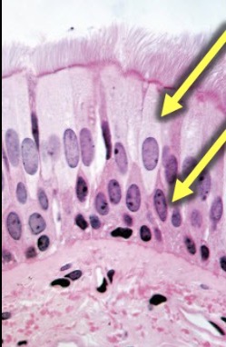 <p>What is the type tissue in this image?</p>