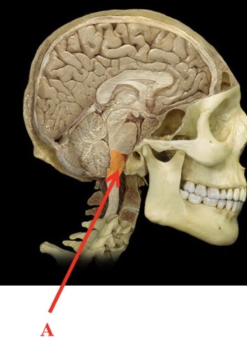 <p>A</p>