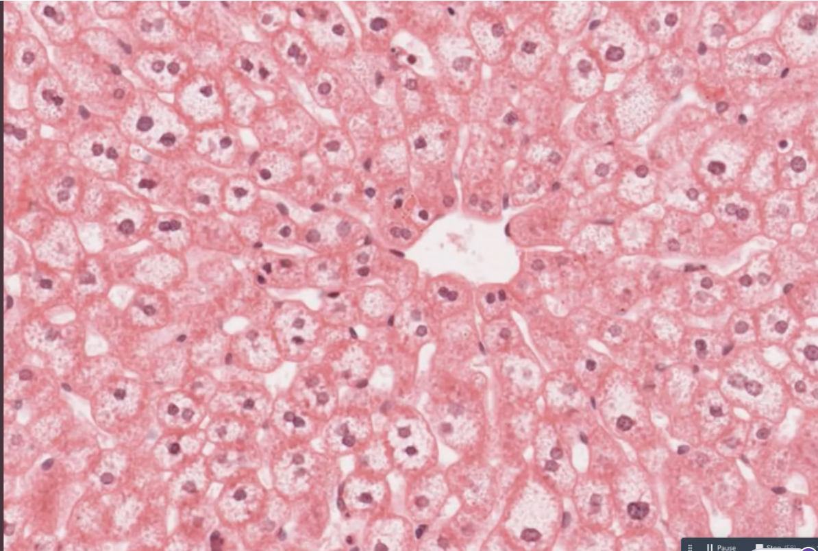 <p>label the middle of the liver lobule </p>