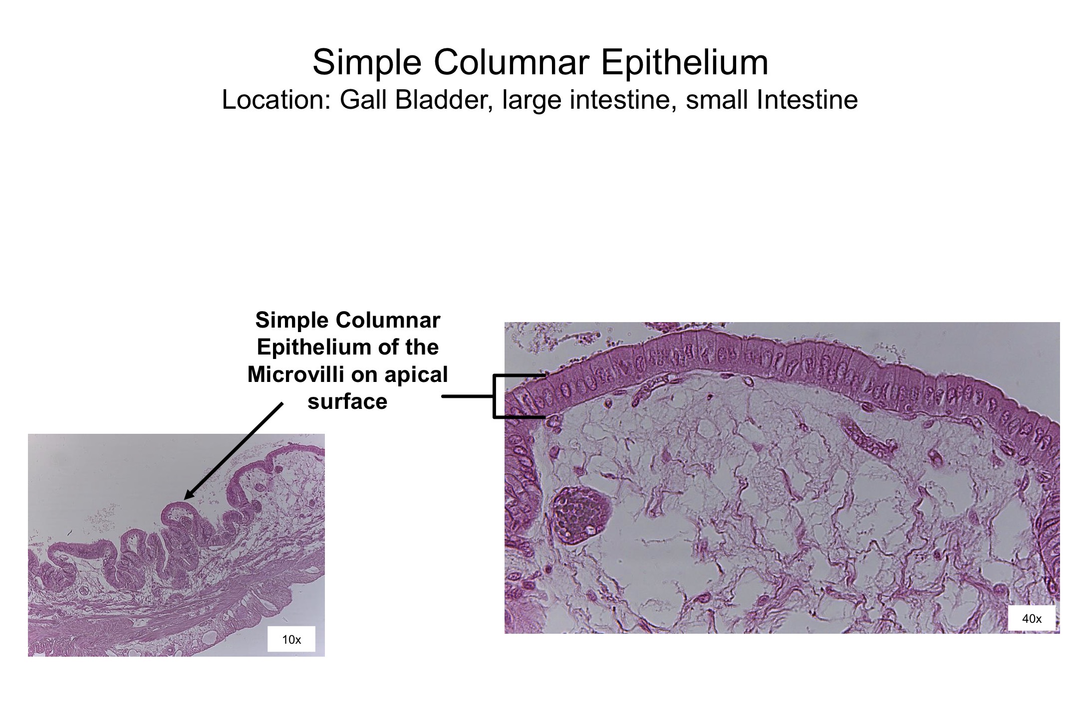 <ol><li><p>Simple columnar epithelium of the microvalili on apical surface </p></li></ol><p></p>