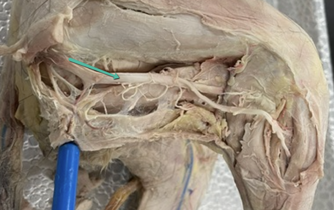 <p><span>Identify the nerve indicated by the pointer.</span></p>