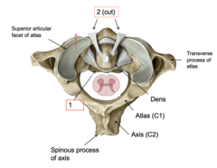 <p>What ligament is at #1?</p>