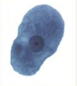<p>What Amaeba is this?</p>
