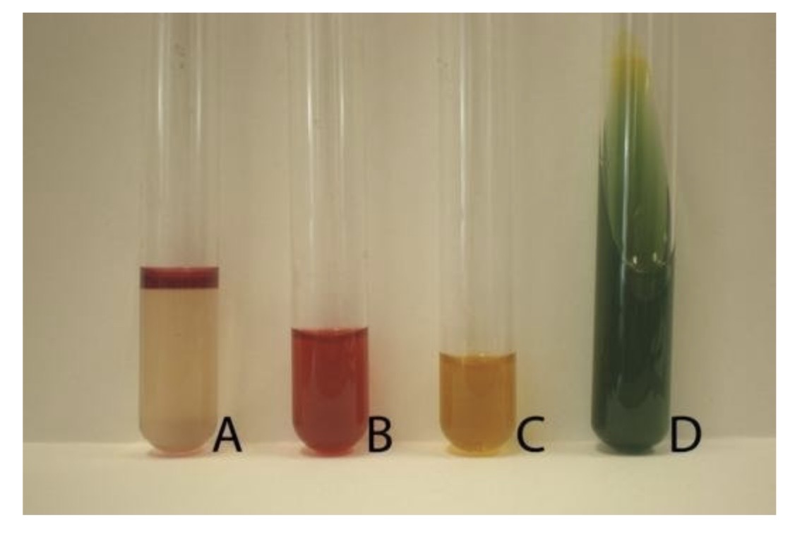 <p>For this question use the 4 Tubes presented</p><p>A. What is the series of tests called? </p><p>B. Which tubes are composed of the MRVP Test? </p><p>C. Does tube D indicate a positive or negative result? </p><p>D. What does the indole test determine? </p>