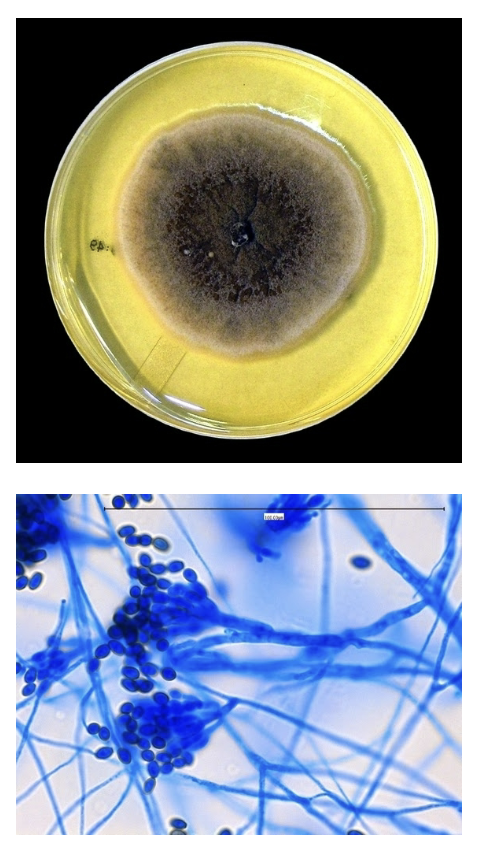 <p>-Contaminants but can cause infection</p><p>-Powdery brown/tan colonies</p><p>-Rough “lemon drop” conidia</p>