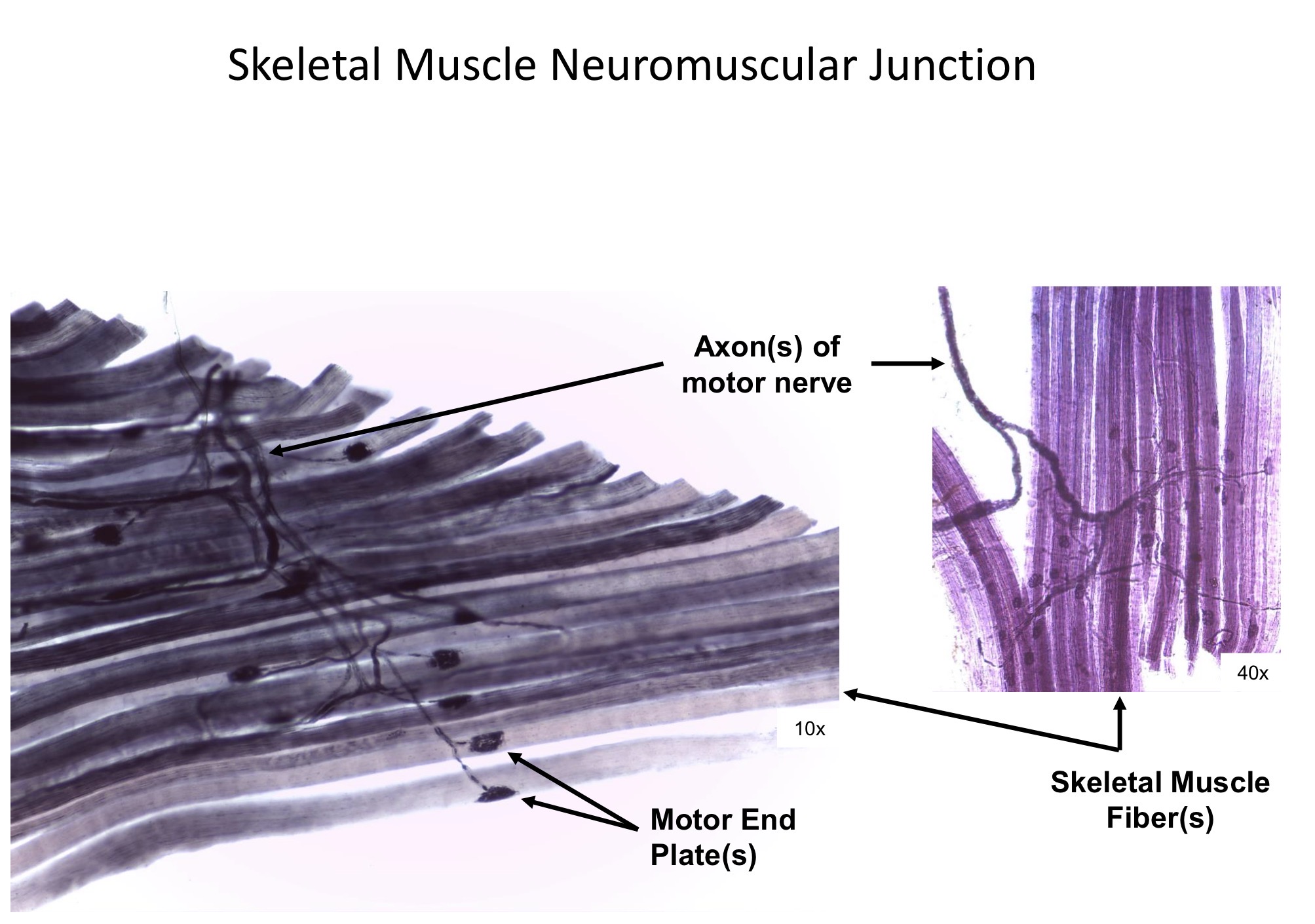 <ol><li><p>Axon of motor nerve</p></li><li><p>Motor end plate </p></li><li><p>Skeletal muscle fibers </p></li></ol><p></p>