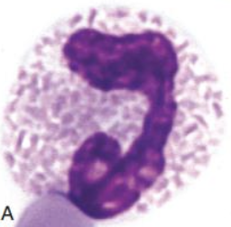<p><span>Which type of white blood cell is shown in this picture? What are the characteristics of this type of white blood cell?</span></p>