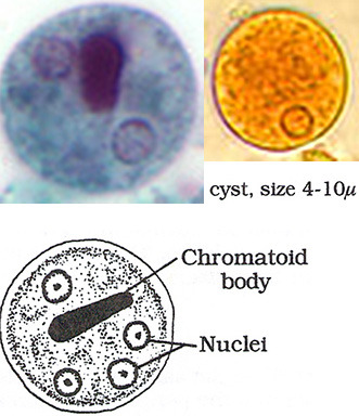 <p>Trophozoite has a small central karyosome with fine chromatin, but is small and NO RBCs</p><p>Cyst has up to 4 nuclei and round chromatin bars</p>