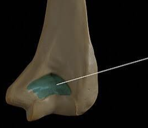 <p>Which bone is this?</p>
