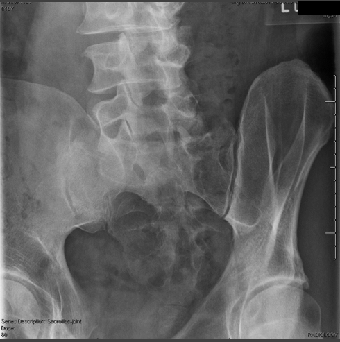 <p>critique for SI obliques </p>