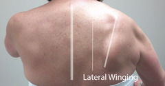 <p>trapezius paralysis = cn 11</p>