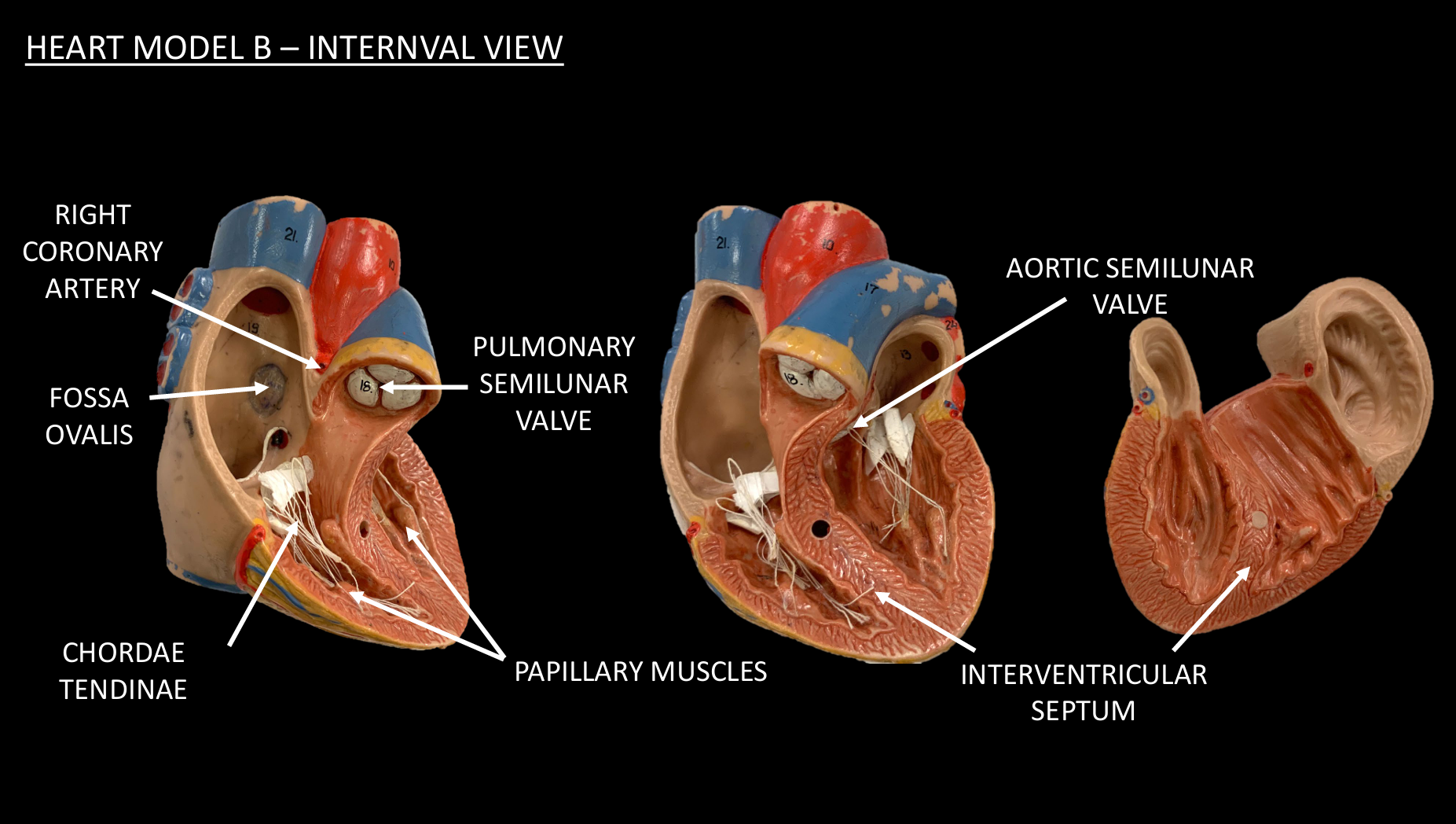 <p>PAPILLARY MUSCLES</p>