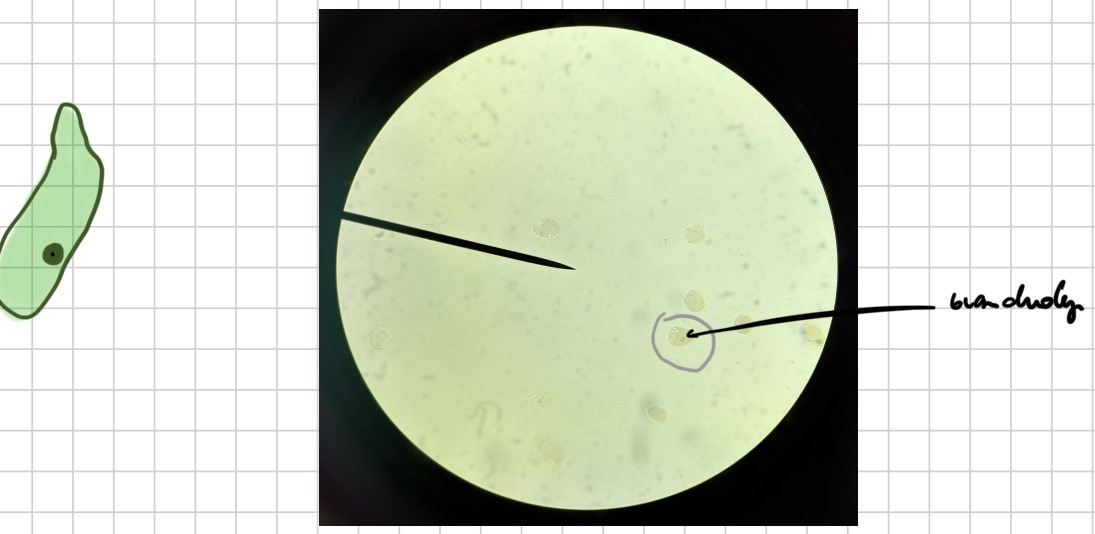 <p>Dizenterine ameba - entamoeba histolytica (trofozoitas - vienas branduolys, pailgas)</p>