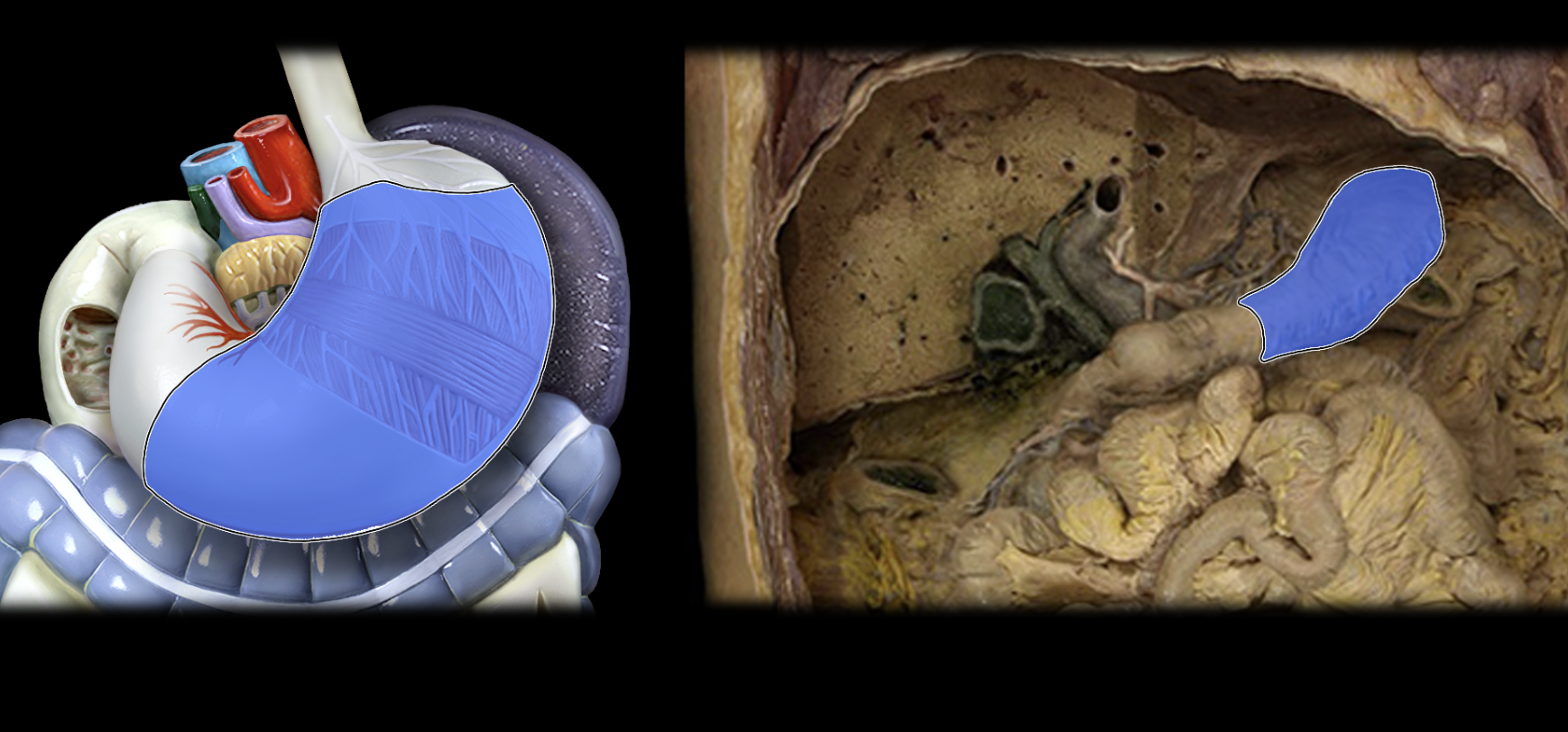 <p>Body of stomach</p>