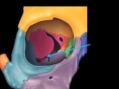 <p>posterior to zygomatic arch</p>
