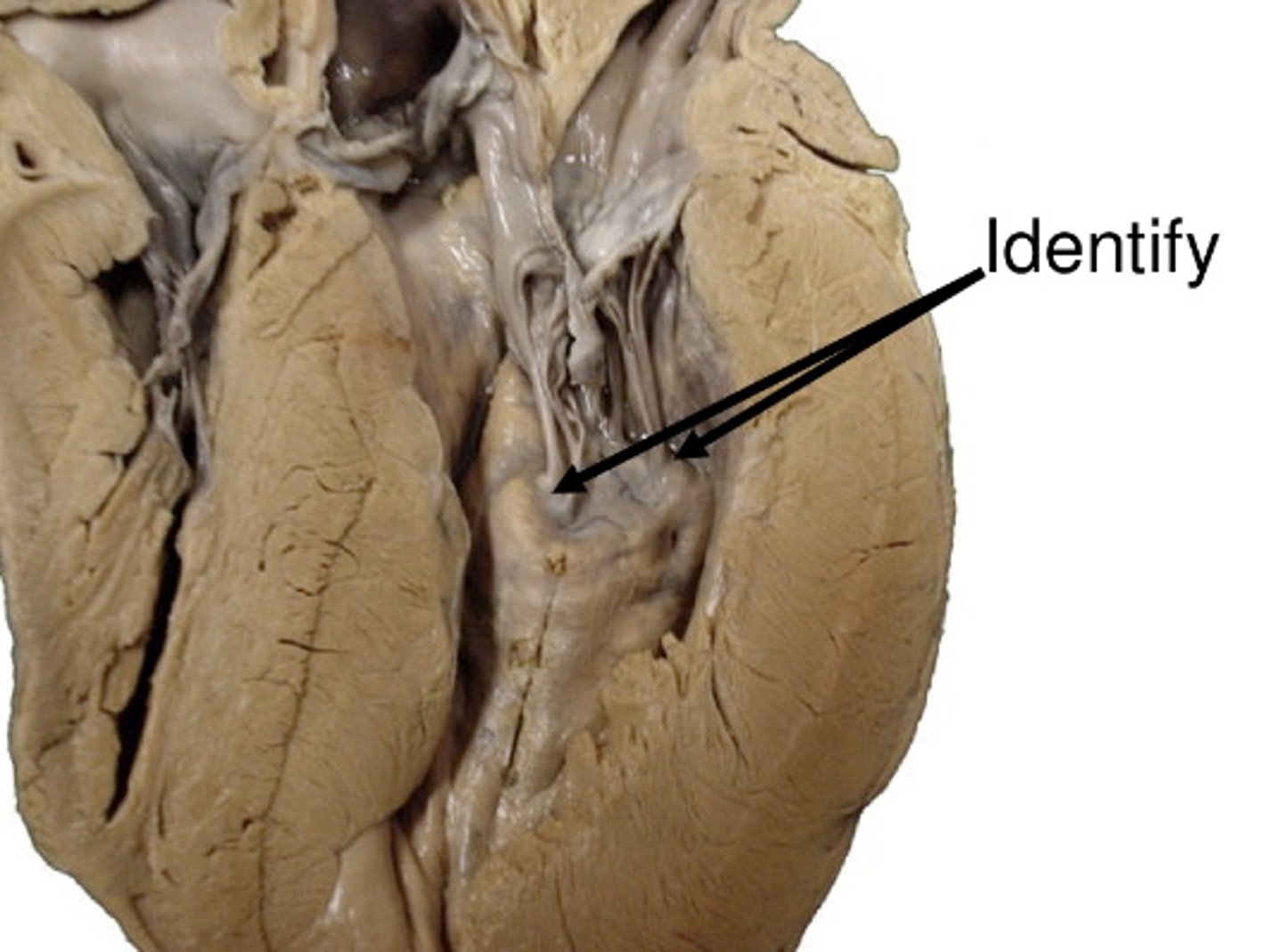 <p>-ventricles</p><p>-anchor chordae tendineae</p>