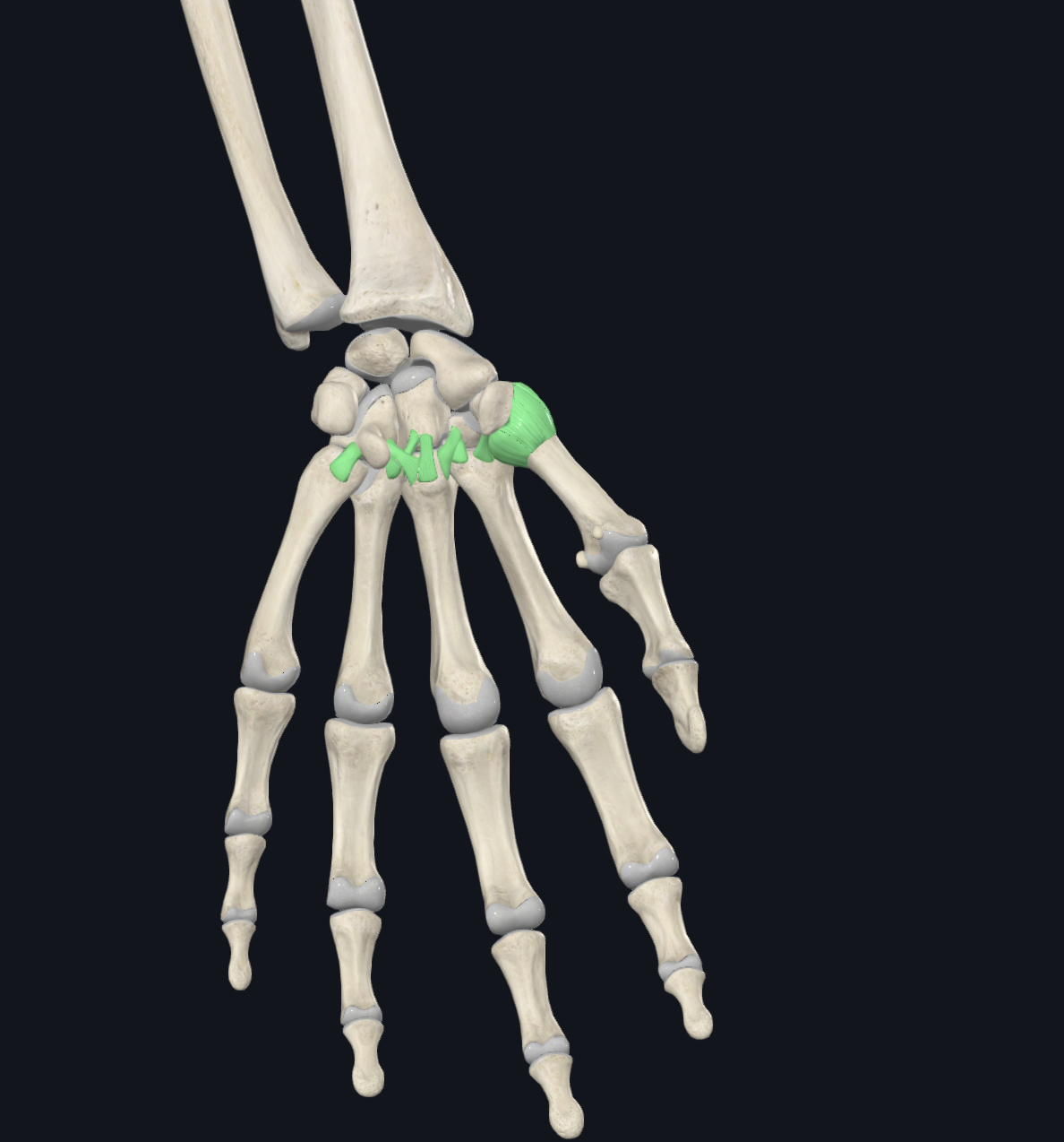 <p>What is this joint?</p>