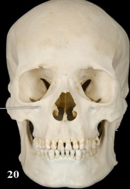 <p>What Foramen is this and What Passes through?</p>