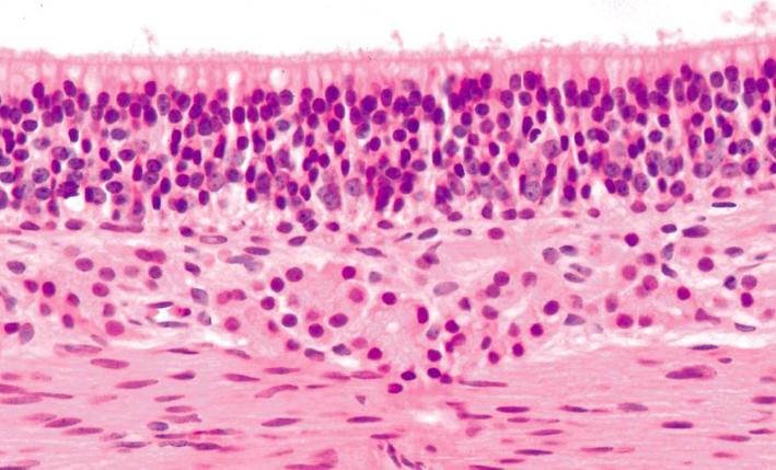 <p>Identify the epithelium shown:</p>