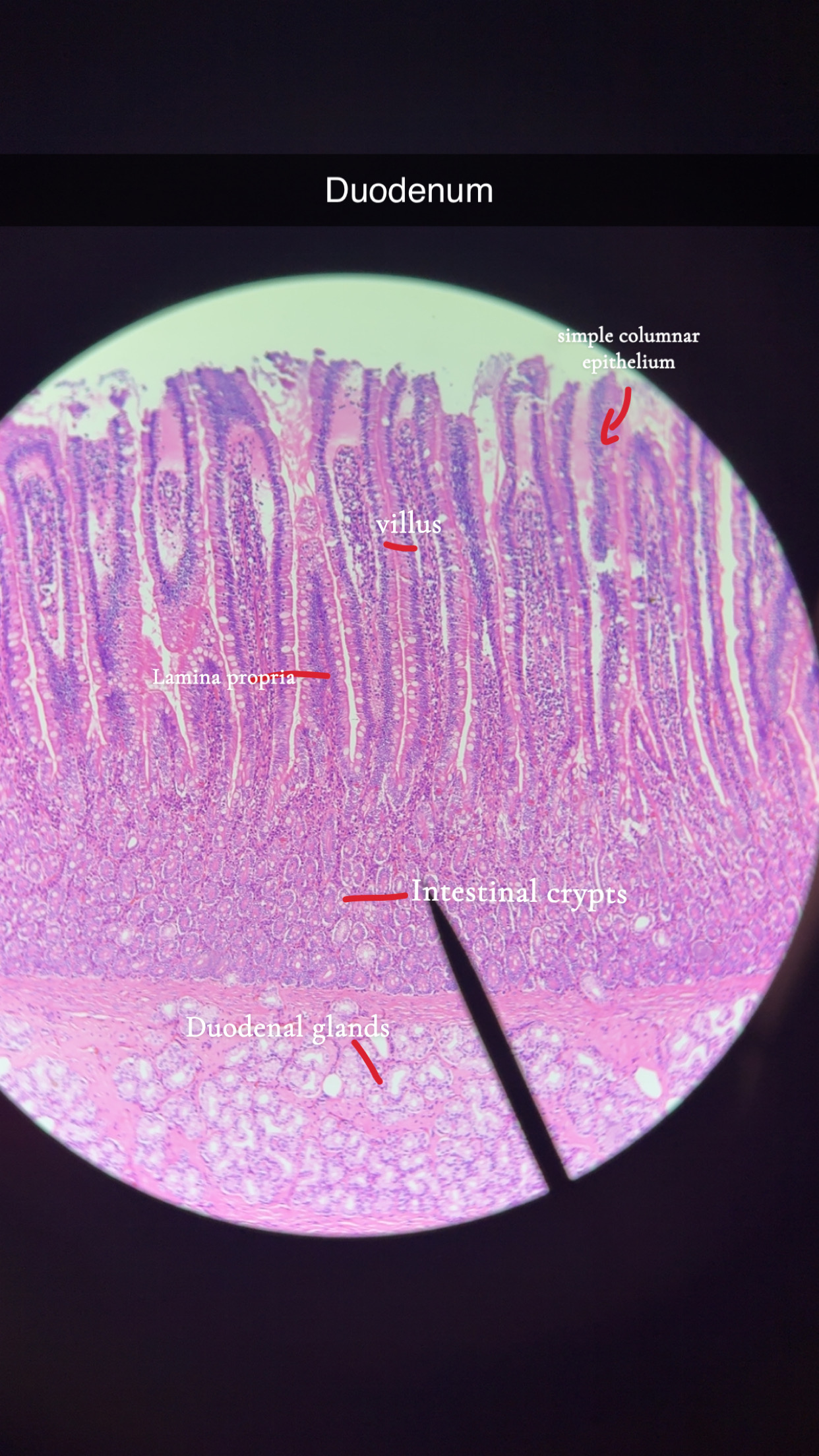 <p>long villi </p><p></p><p>brunner’s gland </p><p></p><p>duodenal glands : produe mucus </p><p></p><p>intestinal crypts : produce intestinal juice </p>