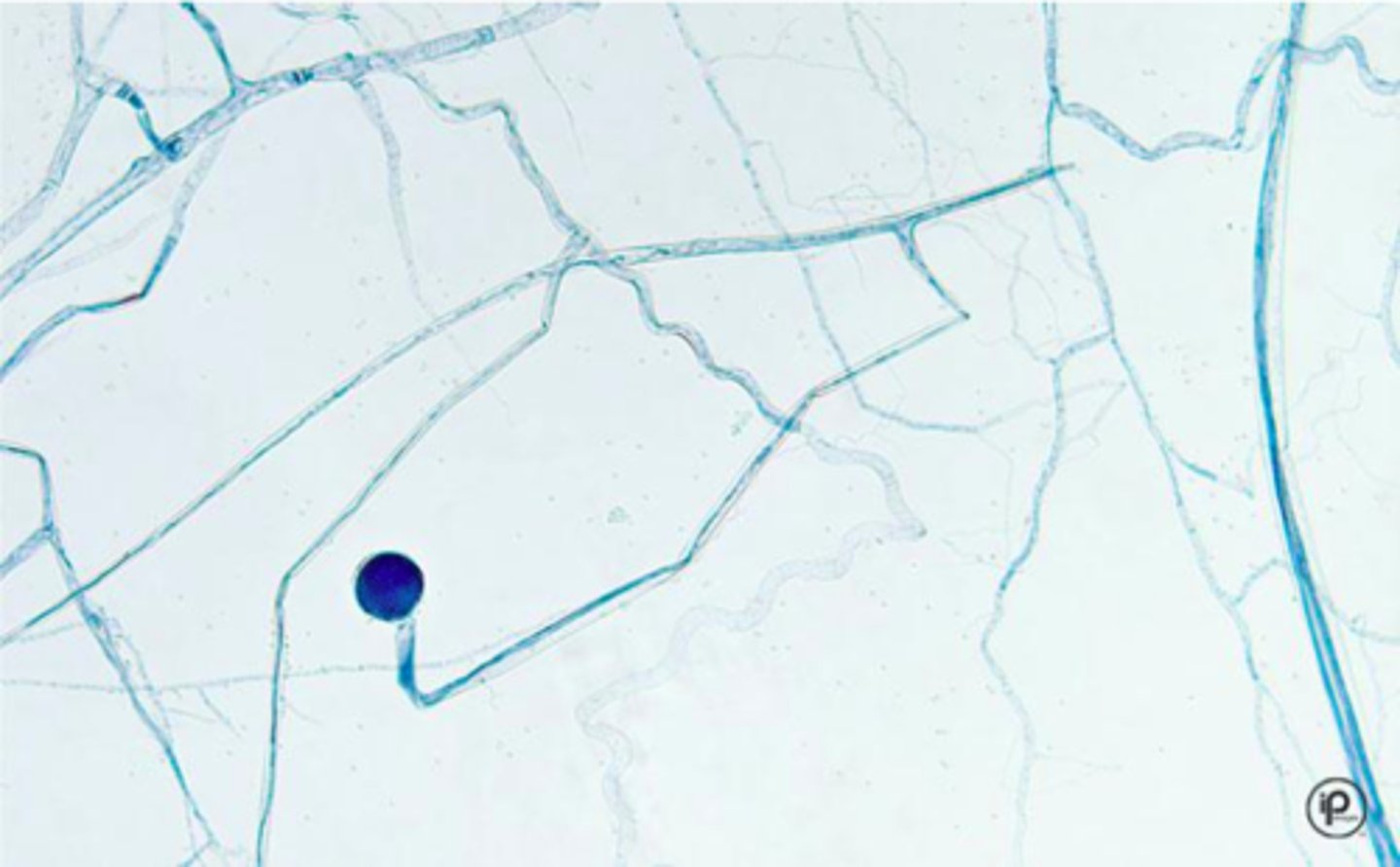 <p>Large, round sporangium</p><p>No rhizoids!!!</p>