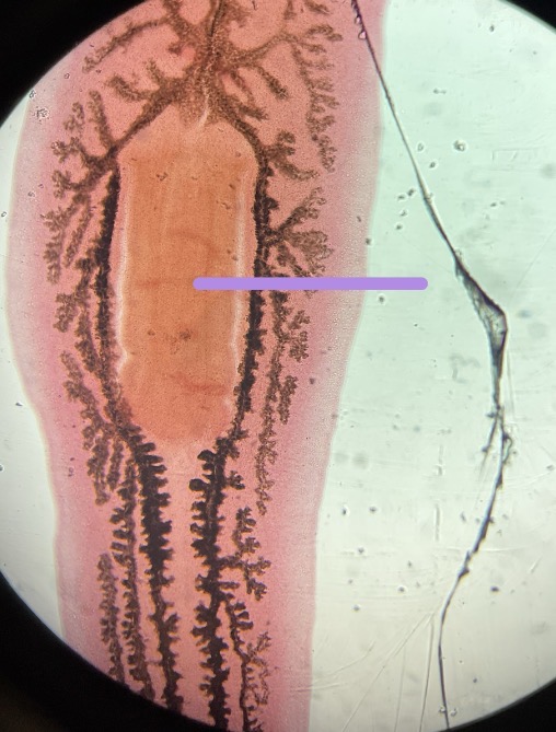 <p>What is this </p>