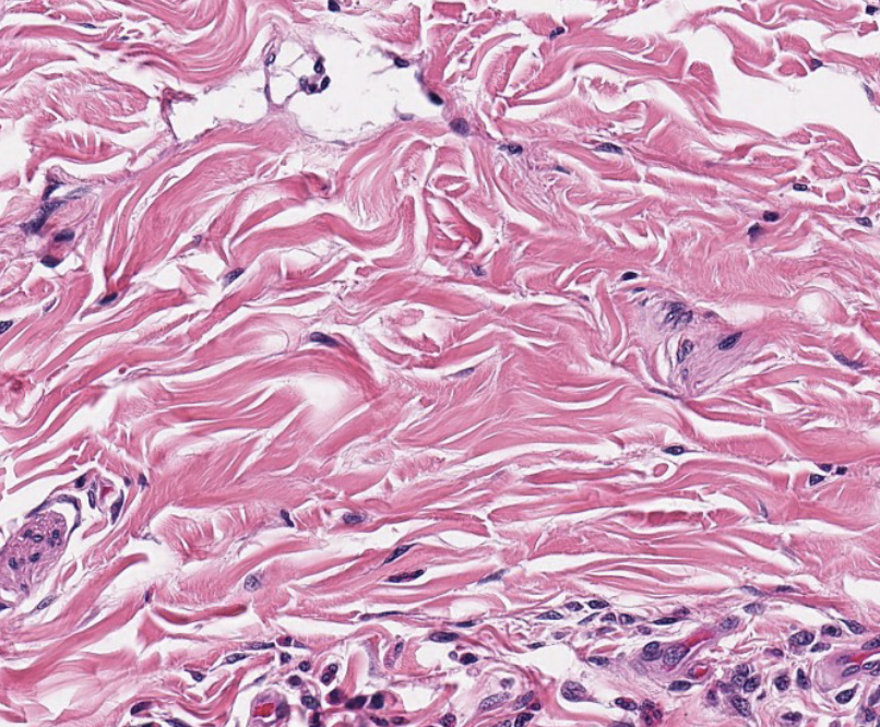 <p>what type of CT is this? be specific.</p>
