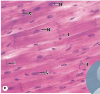 <p>what characteristics does cardiac muscles have?</p>