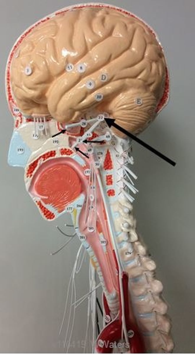 <p>Identify the name and number of this cranial nerve. (small arrows show branches)</p>