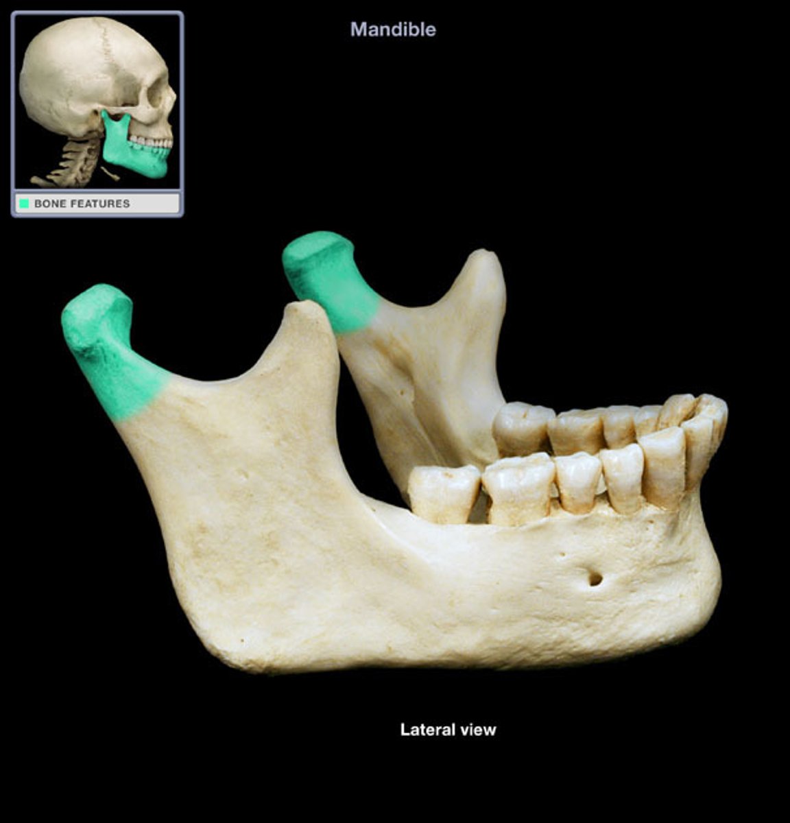 <p>What is this boney feature?</p>