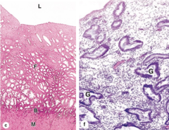 <p>How is the basal layer affected during menstruation?</p>
