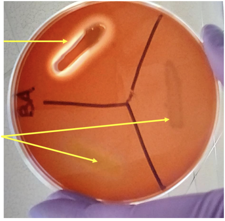 <p>what is bottom two lines?</p>