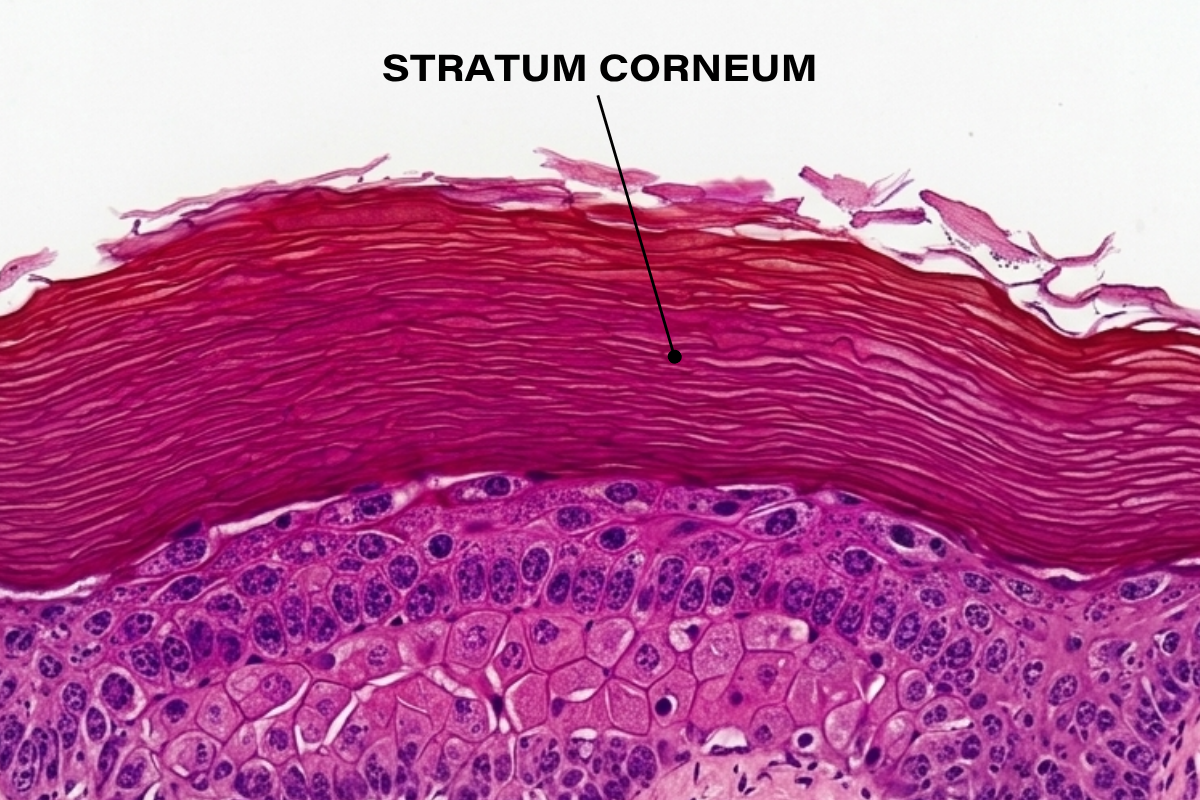 <p>Stratum Corneum</p>