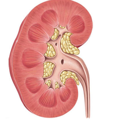 <p><strong>Cavity </strong>lined by the renal capsule. </p><ul><li><p><strong>Anchors </strong>the <strong>ureter, blood vessels, & nerves</strong> in place</p></li><li><p>Filled with <strong>urine-draining structures and adipose tissue </strong></p></li></ul><p></p>