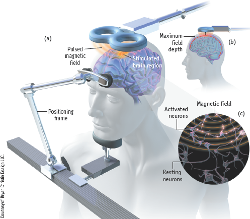 <p><span>A technique that permits scientists to temporarily enhance or depress activity in a specific area of the brain</span></p>