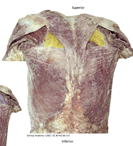 <p>What’s the name of this muscle, and its OIAN</p>