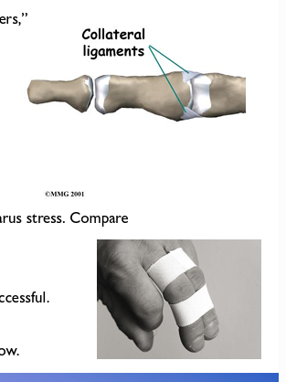 <ul><li><p>Pain at joint, tenderness and swelling. </p></li><li><p>Rule out fracture via direct (palpation) and indirect (axial load) testing </p></li><li><p>Test structure by flexing involved joint to 20-30 and apply valgus and/or varus stress. </p></li><li><p>Compare to finger on contralateral hand</p></li></ul><p></p>