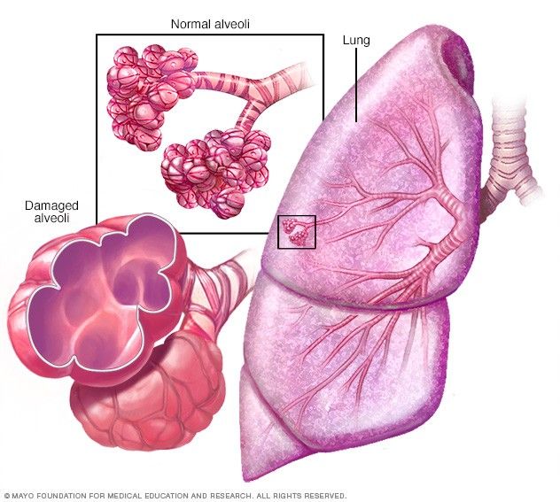 <p>Gas exchange occurs inside the microscopic alveoli.</p>