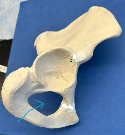 <p>ID Os Coxae hole </p>