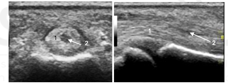 <p>What happened here?</p>