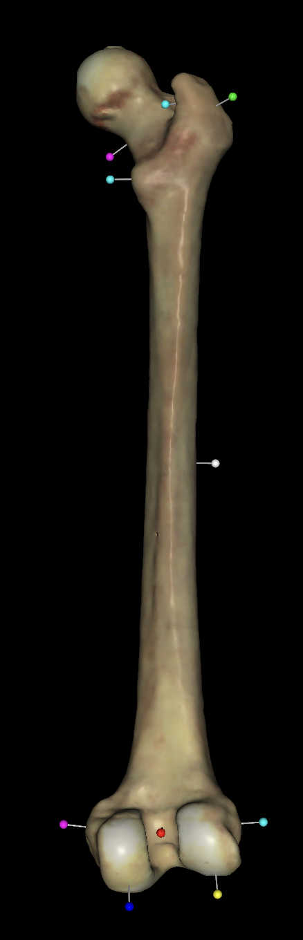 <p>what is the red tag on the right femurs?</p>