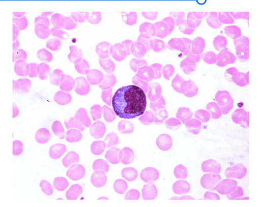 <p>Where are leukocytes found?<br></p>