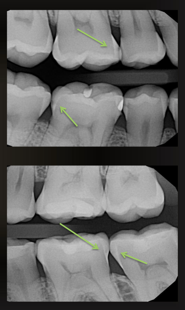 <p>what are the arrows pointing to?</p>