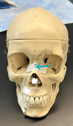<p>ID skull region </p>