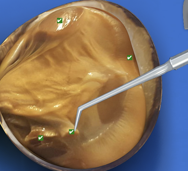 <p>What structure is this pointing to?</p>